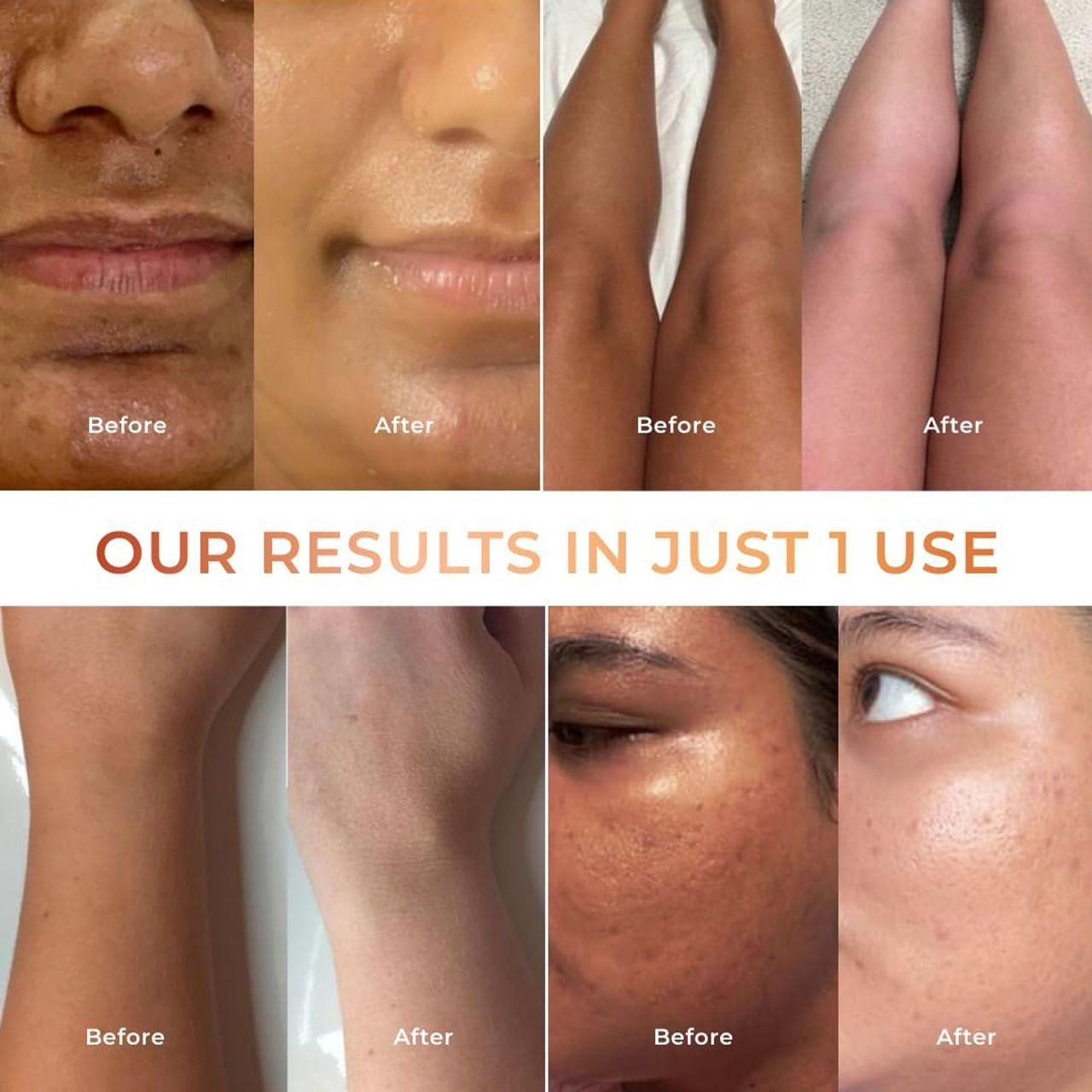 Tan Vanish Glutai Kojic Lotion and Gluta Kojic Serum 100 ml